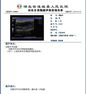 先天性蔓状血管瘤