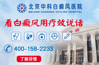 北京白癜风医院治疗效果