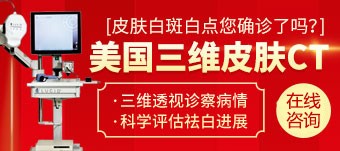 长沙308nm激光治疗白癜风的医院，腰部病发白癜风如何铲除比较好呢