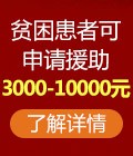 如何预防癫痫发作？黑龙江哪里治癫痫好？