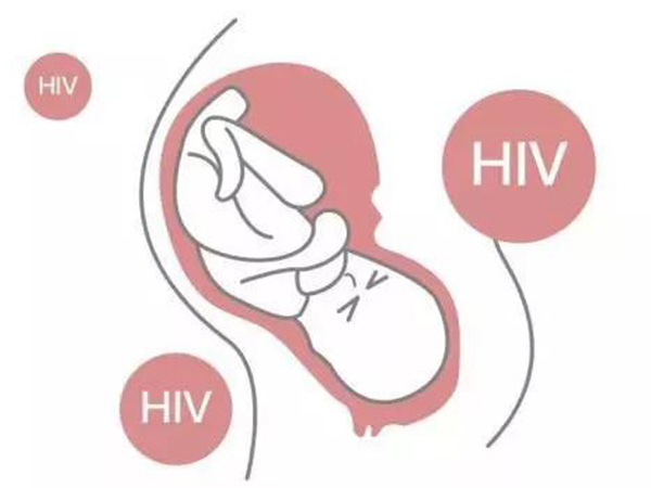 hiv洗精术能避免后代患病