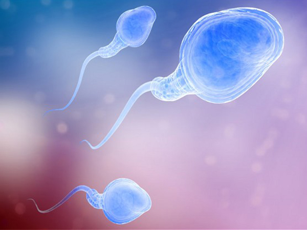 二代试管精子分离技术
