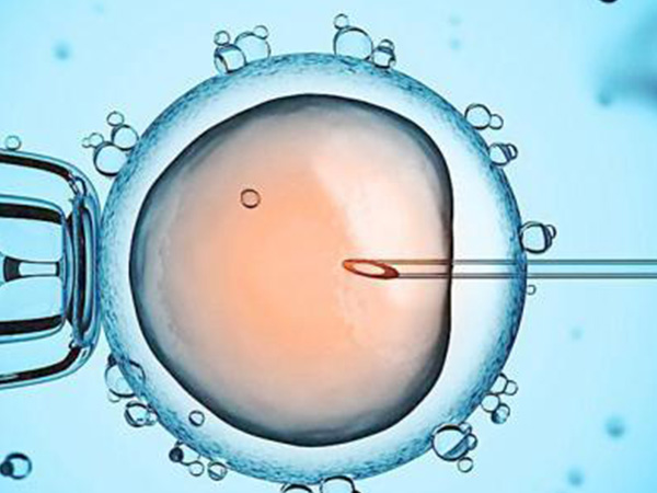 供卵试管可能会引发卵巢刺激