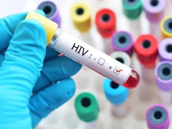 hiv洗精能够得到健康精子