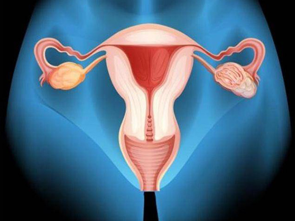 始基子宫在不治疗时一定会不孕