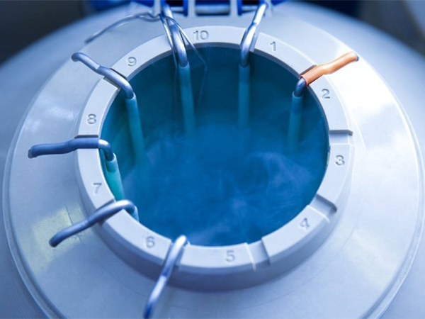 胚胎冷冻技术