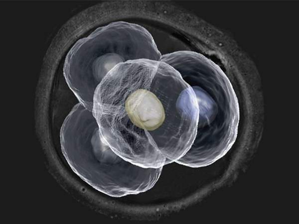 鲜胚和囊胚移植各有优缺点