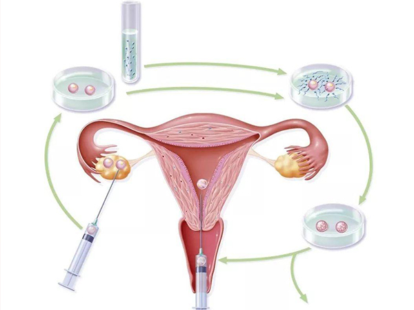 促卵泡激素低会影响怀孕