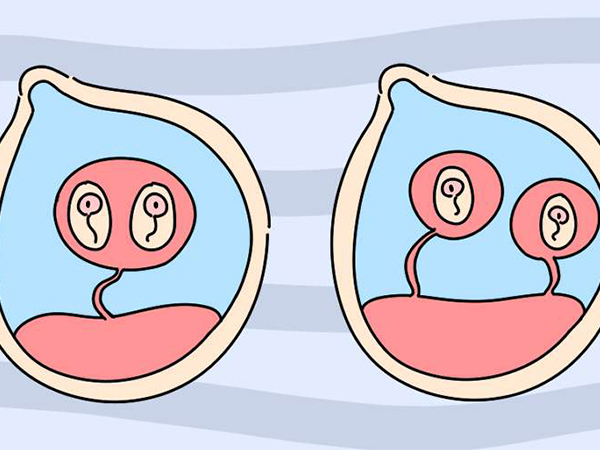 移植一个鲜胚可能变双胞胎