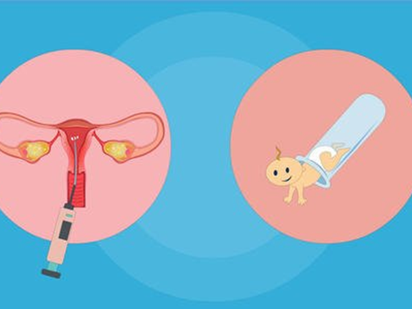 做试管促排卵超长方案是子宫内膜异位症患者的常用方案