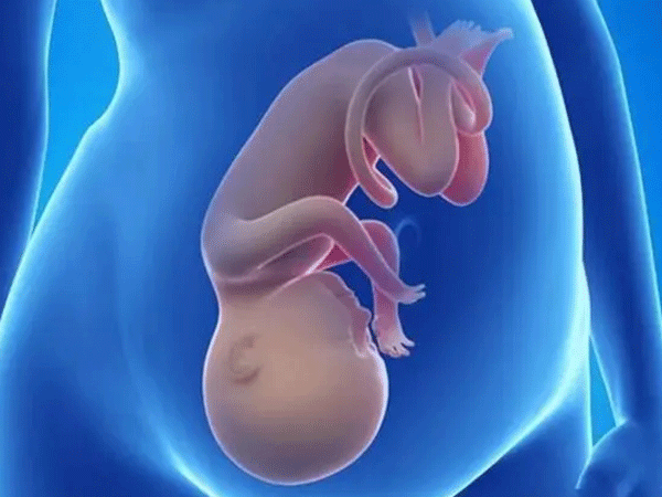 胎位头位是指胎儿头部朝下