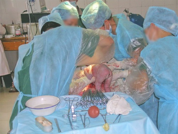 孕妇分娩实拍顺产图片