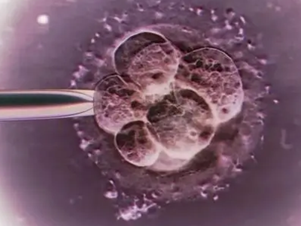 医生建议卵巢功能不太好的女性养囊