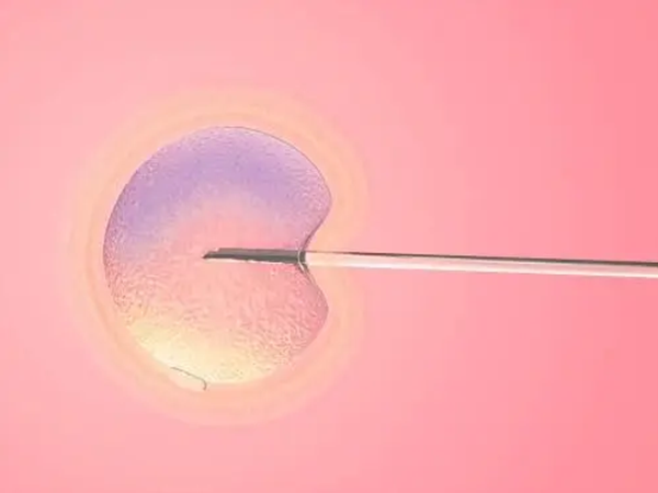 囊胚移植前要检查双侧卵巢