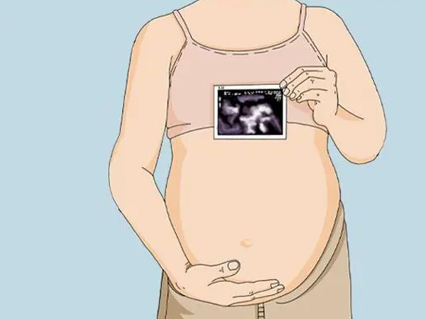 孕期大排畸和小排畸都需要做