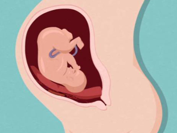 多胎妊娠会增加胎盘前置的概率较高