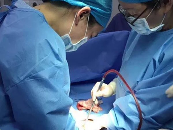 畸胎瘤可以做腹腔镜手术