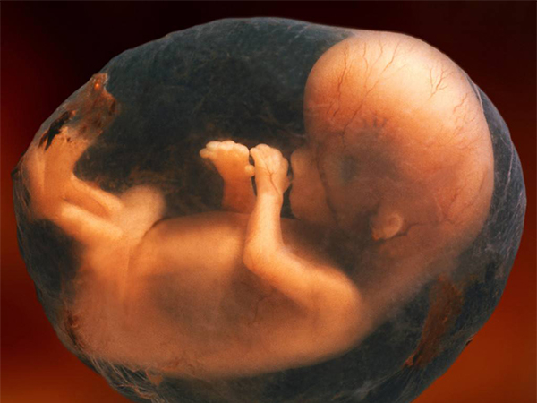 22周胎儿四维彩超图图片