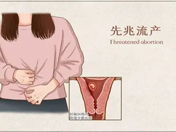 先兆流产一半主要看阴道有没有出血的情况