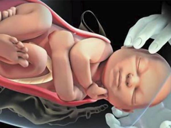 胎儿头围在低于40cm可顺产