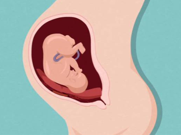 胎动感受格外强烈属于胎动异常