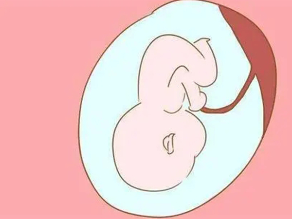 孕期检查出孕空囊属于难免流产