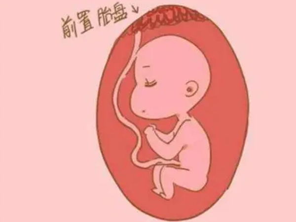 胎盘前置孕妇生产时比较危险
