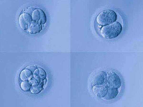 胚胎等级不能判断胎儿性别