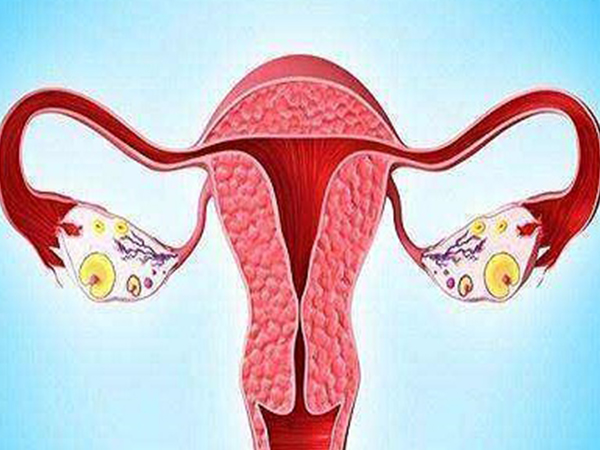 多囊卵巢综合征是不能被治愈的