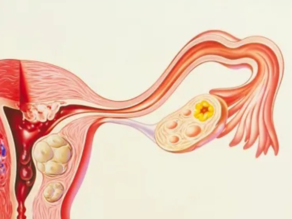输卵管堵塞可以做试管受孕