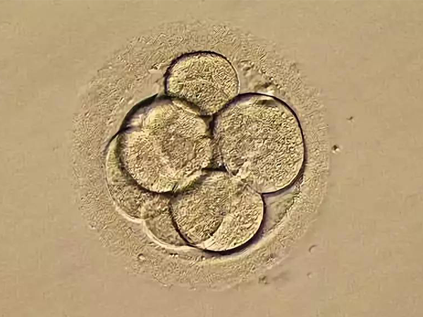 4ac囊胚是扩张期囊胚