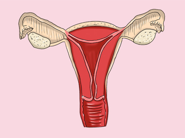 子宫腺肌症的根治方法是切除子宫