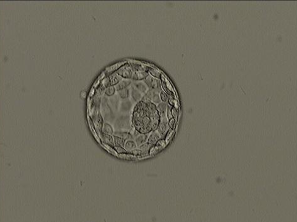 5bb囊胚也属于优质囊胚