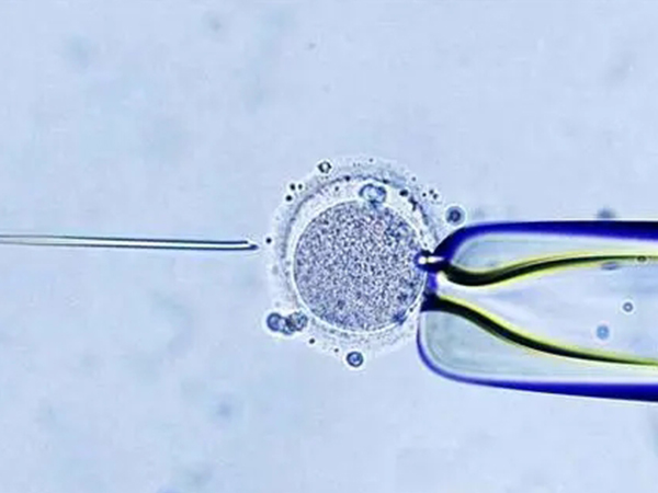 鲜胚移植对女性身体条件要求高
