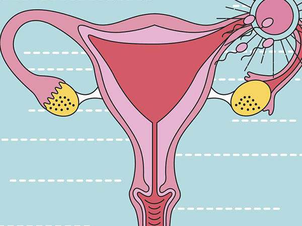 子宫肌瘤在不同位置对胎儿影响不同