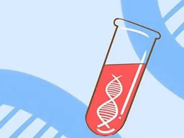 无创DNA是一种产前诊断