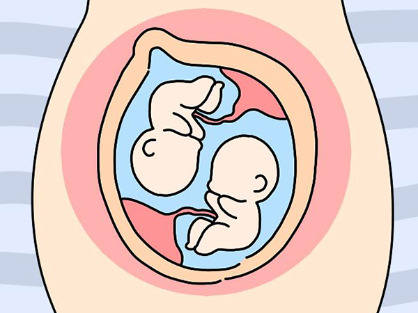 异卵双胞胎受胎膜阻挡不会伤到对方