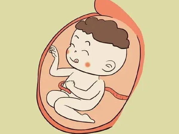 胎儿脑积水可能是患染色体异常疾病