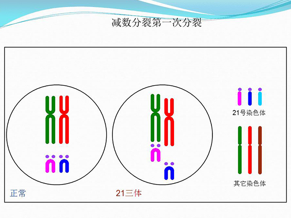21三体是染色体错误分配导致的
