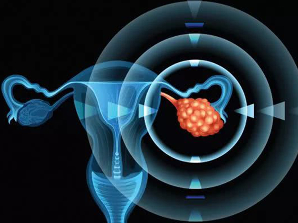 卵巢早衰能否怀孕需据病症程度而定