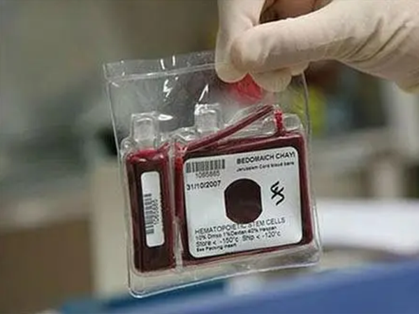 北京储存22年脐带血要花费2万左右