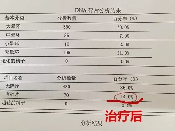 精子DNA碎片率分析报告