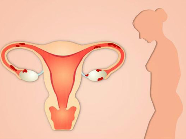 子宫内膜对胚胎着床影响大