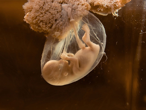 胚胎着床后乳房会变得柔软