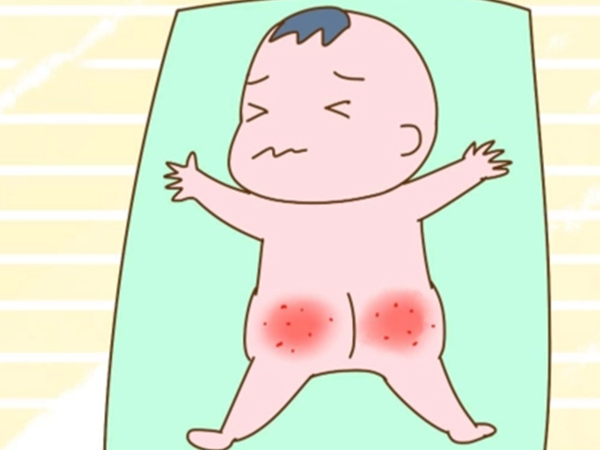 患有尿布疹的宝宝皮肤会发红