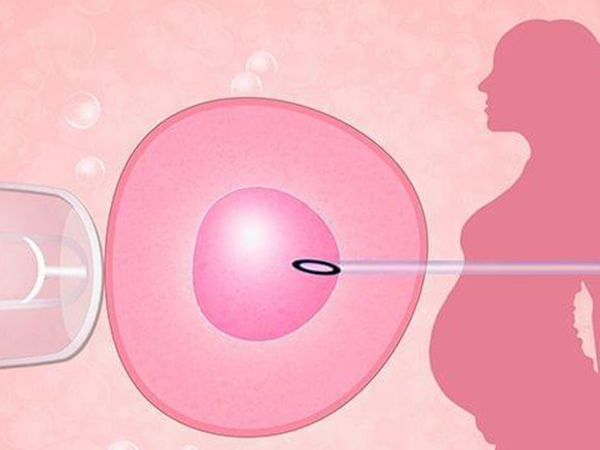 体外受精通常在取卵后1-2天完成