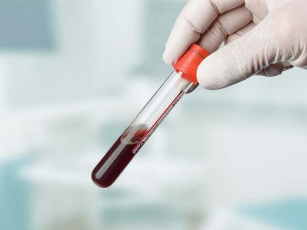 DNA验血可以判断胎儿性别