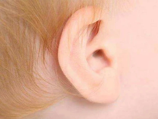一胎耳朵看二胎性别不靠谱