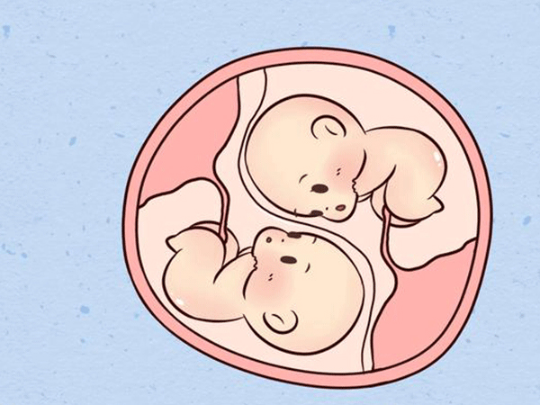 双胎的宝宝容易胎位不正