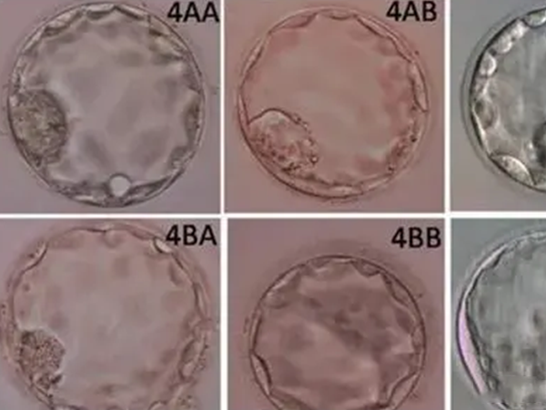 4BB中的4代表不同扩张期囊胚